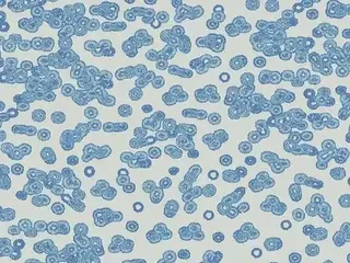 Forbo Flotex Sottsass флокированное ковровое покрытие Flotex Bacteria 990202