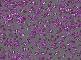 Forbo Flotex Sottsass флокированное ковровое покрытие Flotex Bacteria 990301